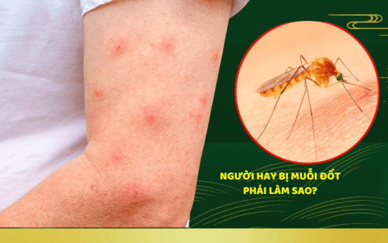 người hay bị muỗi đốt phải làm sao