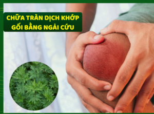 chua-tran-dich-khop-goi-bang-ngai-cuu